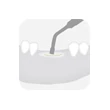 1279 470 Piezomed-Instrument B4 - Tooth ilustration 72dpi