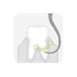 1336 489 Piezomed-Instrument P2LD - Tooth ilustration 72dpi