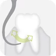 1343 492 Piezomed-Instrument P2RD - Tooth ilustration 150dpi