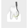 1987 727 Piezo Scaler-Tip 3Pr  Tooth illustration 72dpi