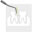 1996 730 Piezo Scaler-Tip 3Rd  Tooth illustration 72dpi