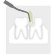 2005 733 Piezo Scaler-Tip 3Rm  Tooth illustration 72dpi