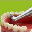 2568 922 Proxeo-Cleaning and polishing interdental 72dpi